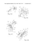 FOREHEAD SUPPORTS FOR FACIAL MASKS diagram and image