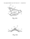 FOREHEAD SUPPORTS FOR FACIAL MASKS diagram and image