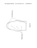 Deicing System in Sodar Systems diagram and image