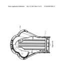 Deicing System in Sodar Systems diagram and image