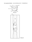 HYDROCARBON PRODUCTION FROM MINES AND TUNNELS USED IN TREATING SUBSURFACE HYDROCARBON CONTAINING FORMATIONS diagram and image