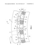 RELEASEABLE ONE-WAY CLUTCH diagram and image