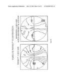 STATIC PROGRESSIVE SURFACE REGION IN OPTICAL COMMUNICATION WITH A DYNAMIC OPTIC diagram and image