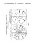 STATIC PROGRESSIVE SURFACE REGION IN OPTICAL COMMUNICATION WITH A DYNAMIC OPTIC diagram and image