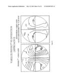 STATIC PROGRESSIVE SURFACE REGION IN OPTICAL COMMUNICATION WITH A DYNAMIC OPTIC diagram and image