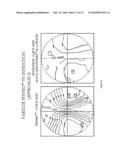 STATIC PROGRESSIVE SURFACE REGION IN OPTICAL COMMUNICATION WITH A DYNAMIC OPTIC diagram and image