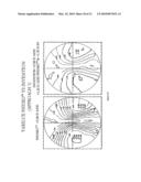 STATIC PROGRESSIVE SURFACE REGION IN OPTICAL COMMUNICATION WITH A DYNAMIC OPTIC diagram and image