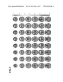 DEVICE FOR GENERATING ALTERNATIVE OF NORMAL BRAIN DATABASE diagram and image