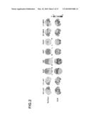 DEVICE FOR GENERATING ALTERNATIVE OF NORMAL BRAIN DATABASE diagram and image