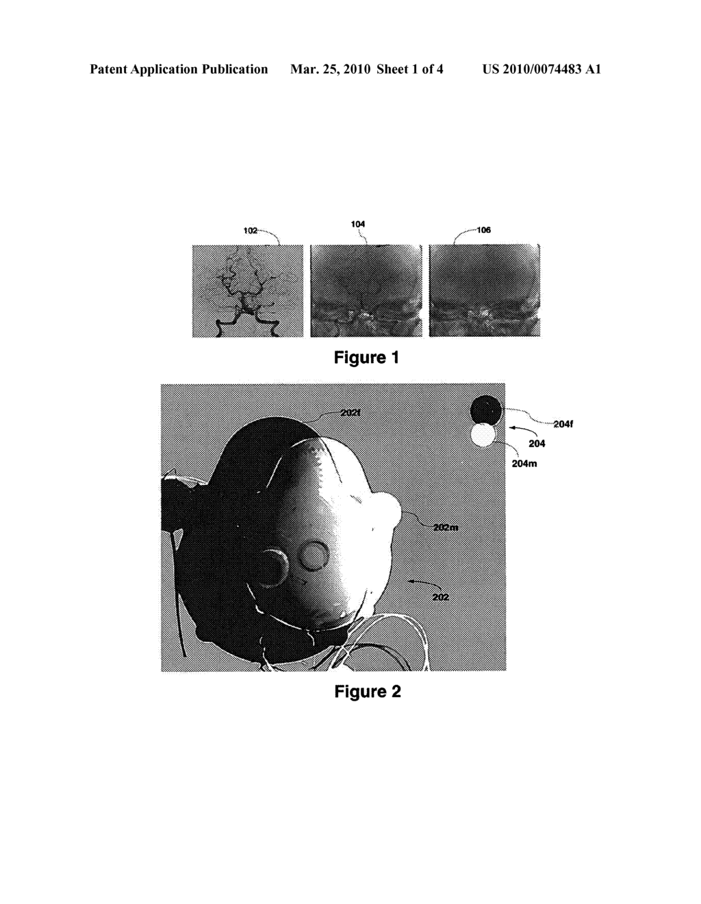 Imaging System for Compensating for Mask Frame Misalignment - diagram, schematic, and image 02