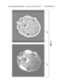 AC-PC SEGMENTATION SYSTEM AND METHOD diagram and image