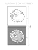 AC-PC SEGMENTATION SYSTEM AND METHOD diagram and image