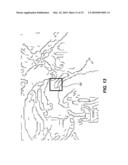 AC-PC SEGMENTATION SYSTEM AND METHOD diagram and image