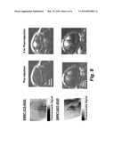 ENHANCED SENSITIVITY CARBON NANOTUBES AS TARGETED PHOTOACOUSTIC MOLECULAR IMAGING AGENTS diagram and image