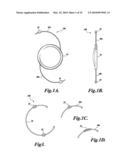 DEVICE AND METHOD FOR INTRAOCULAR DRUG DELIVERY diagram and image