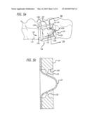 ACCESSORY MOUNTING CLIP FOR ORTHODONTIC ALIGNER TRAYS diagram and image