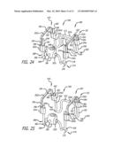 ACCESSORY MOUNTING CLIP FOR ORTHODONTIC ALIGNER TRAYS diagram and image