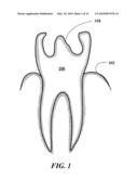 Dental Prosthetics Having Improved Aesthetic Appearance and Method of Preparing Same diagram and image