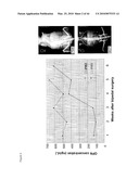 METHOD OF DETERMINING THE RISK OF SCOLIOSIS diagram and image