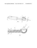 Spider Vein Treatment Apparatus diagram and image