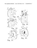 SYSTEM FOR COMPRESSION THERAPY diagram and image