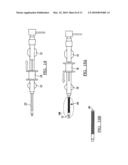 ENDOVASCULAR SHEATH WITH GRADABLE STIFFNESS DEVICE AND METHOD diagram and image