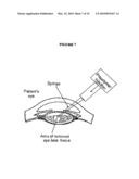 Devices, Methods and Compositions for Presbyopia Correction Using Ultrashort Pulse Laser diagram and image