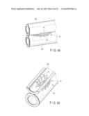 HOLLOW TISSUE INOSCULATION APPARATUS diagram and image