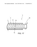 SYSTEMS AND METHODS FOR CABLE-BASED TISSUE REMOVAL diagram and image