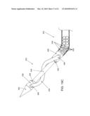 SYSTEMS AND METHODS FOR CABLE-BASED TISSUE REMOVAL diagram and image