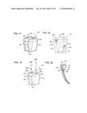 Curvilinear spinal access method and device diagram and image