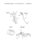 Curvilinear spinal access method and device diagram and image