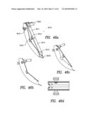 Curvilinear spinal access method and device diagram and image