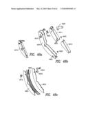 Curvilinear spinal access method and device diagram and image