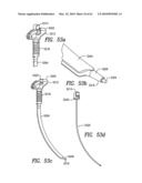 Curvilinear spinal access method and device diagram and image