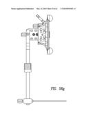 Curvilinear spinal access method and device diagram and image