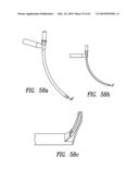 Curvilinear spinal access method and device diagram and image