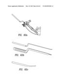 Curvilinear spinal access method and device diagram and image