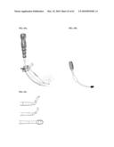 Curvilinear spinal access method and device diagram and image