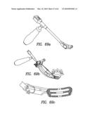 Curvilinear spinal access method and device diagram and image