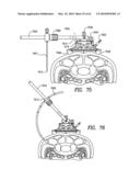 Curvilinear spinal access method and device diagram and image