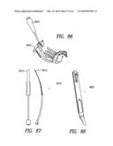 Curvilinear spinal access method and device diagram and image