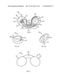 SYSTEM FOR TRANSMITTING ELECTRICAL CURRENT TO A BODILY TISSUE diagram and image