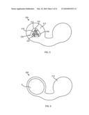 SYSTEM FOR TRANSMITTING ELECTRICAL CURRENT TO A BODILY TISSUE diagram and image