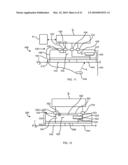 SYSTEM FOR TRANSMITTING ELECTRICAL CURRENT TO A BODILY TISSUE diagram and image