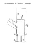 SYSTEM AND METHOD FOR DELIVERING A BIFURCATED STENT diagram and image