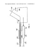 SYSTEM AND METHOD FOR DELIVERING A BIFURCATED STENT diagram and image