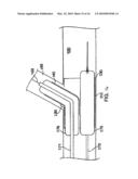 SYSTEM AND METHOD FOR DELIVERING A BIFURCATED STENT diagram and image