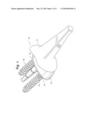 PROSTHETIC WRIST IMPLANT diagram and image