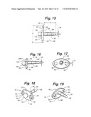 PROSTHETIC WRIST IMPLANT diagram and image